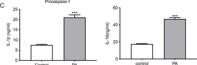 Fig.2.C showing Enzyme-linked immunosorbent assay from the publication: Adiponectin protects obesity-related glomerulopathy by inhibiting ROS/NF-κB/NLRP3 inflammation pathway.