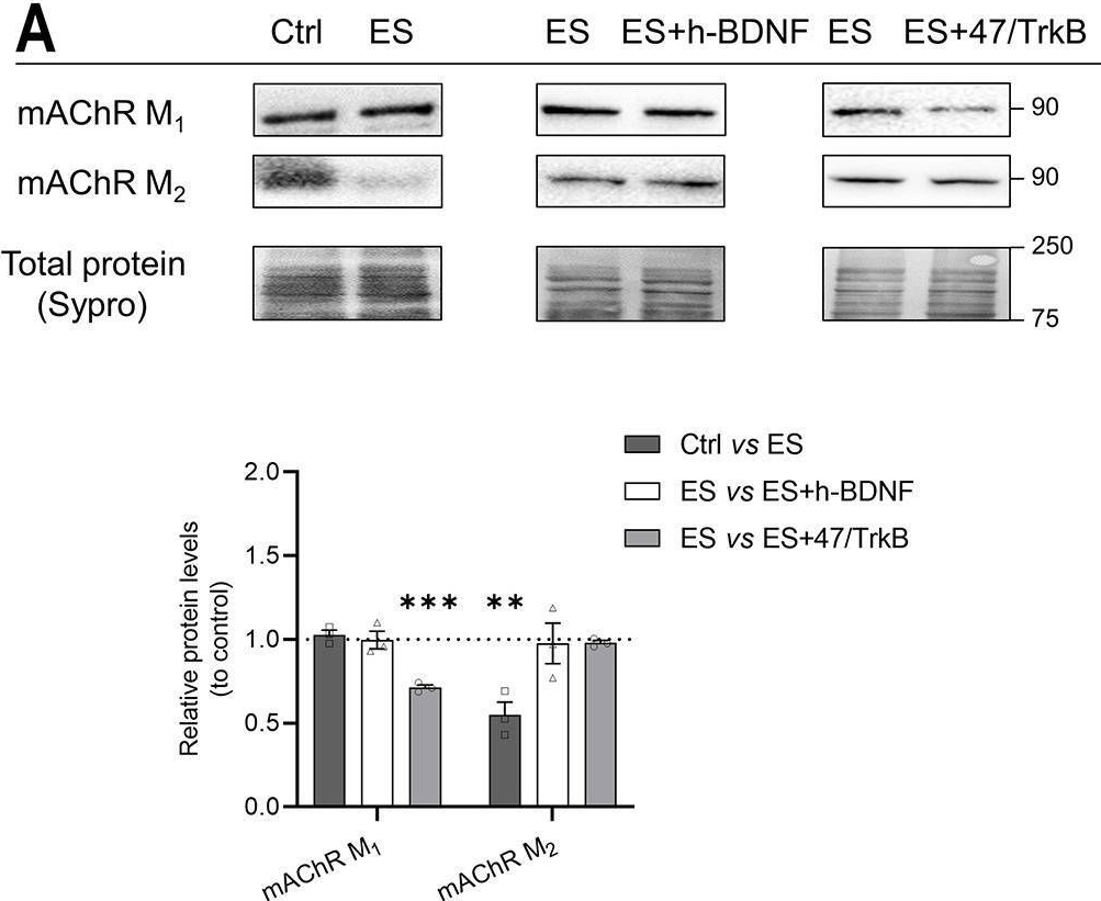 Fig.6.A showing Western Blotting in a Rattus norvegicus (Rat) sample from the publication: BDNF/TrkB signalling, in cooperation with muscarinic signalling, retrogradely regulates PKA pathway to phosphorylate SNAP-25 and Synapsin-1 at the neuromuscular junction.