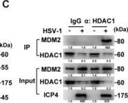 まる☆確認ページ MDM2 (D1V2Z) Rabbit Monoclonal Antibody | Cell Signaling Technology