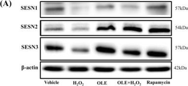 Fig.7.A showing Western Blotting from the publication: Oleuropein Aglycone Modulates Oxidative Stress and Autophagy-Related Pathways in Human Skeletal Muscle Cells.