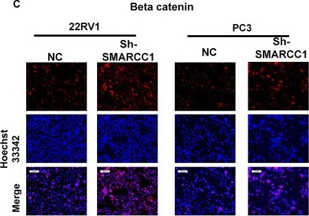 Fig.5.C showing Immunocytochemistry-immunofluorescence in a Homo sapiens (Human) sample from the publication: SMARCC1 Suppresses Tumor Progression by Inhibiting the PI3K/AKT Signaling Pathway in Prostate Cancer.