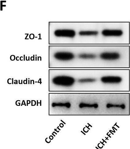 Fig.10.F showing Western Blotting in a Mus musculus (House mouse) sample from the publication: Identification of novel gut microbiota-related biomarkers in cerebral hemorrhagic stroke.