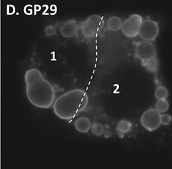 Differential phosphorylation of perilipin 1A at the initiation of lipolysis revealed by novel monoclonal antibodies and high content analysis.