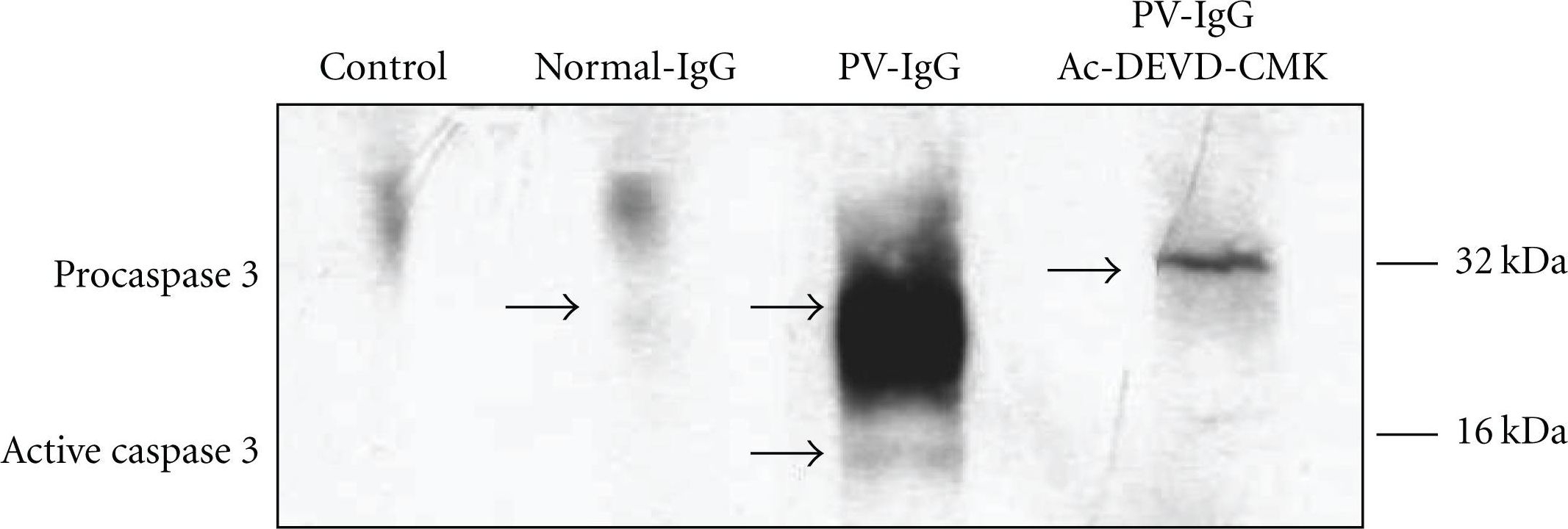 Fig.3.A showing Western Blotting in a Mus musculus (House mouse) sample from the publication: The caspase pathway as a possible therapeutic target in experimental pemphigus.