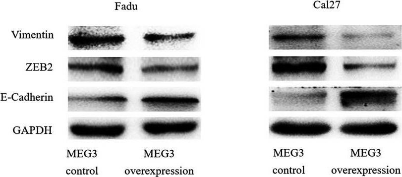 Fig.3.A showing Western Blotting in a Homo sapiens (Human) sample from the publication: Long noncoding RNA MEG3 decreases the growth of head and neck squamous cell carcinoma by regulating the expression of miR-421 and E-cadherin.