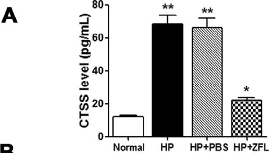 Fig.7.A showing Enzyme-linked immunosorbent assay from the publication: Excess fatty acids induce pancreatic acinar cell pyroptosis through macrophage M1 polarization.