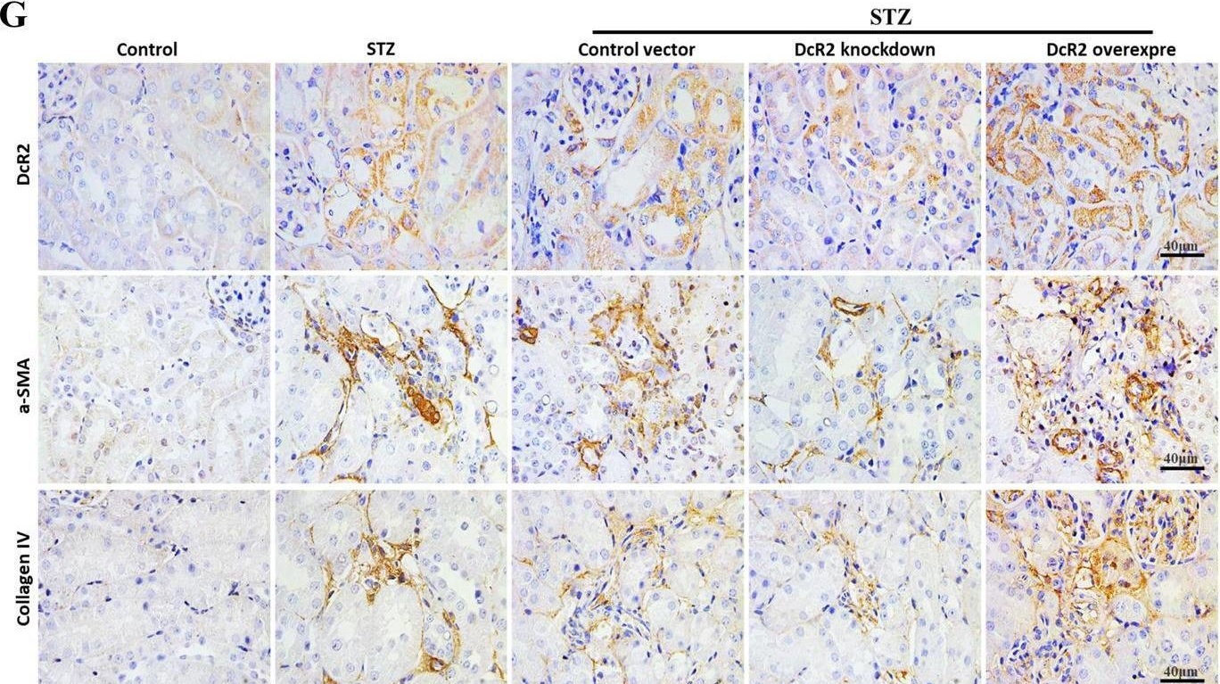 Fig.2.G showing Immunohistochemistry from the publication: Decoy receptor 2 mediates the apoptosis-resistant phenotype of senescent renal tubular cells and accelerates renal fibrosis in diabetic nephropathy.