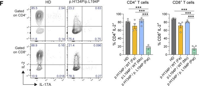 Fig.4.F showing Flow cytometry/Cell sorting in a Homo sapiens (Human) sample from the publication: ORAI1 mutation with mixed loss and gain of function properties causes immunodeficiency and HLH.