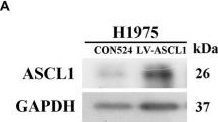Fig.6.A showing Western Blotting in a Homo sapiens (Human) sample from the publication: Bioinformatics-based screening of key genes for transformation of tyrosine kinase inhibitor-resistant lung adenocarcinoma to small cell lung cancer.