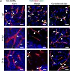 Fig.2.D showing Immunohistochemistry in a Mus musculus (House mouse) sample from the publication: Optical blood-brain-tumor barrier modulation expands therapeutic options for glioblastoma treatment.