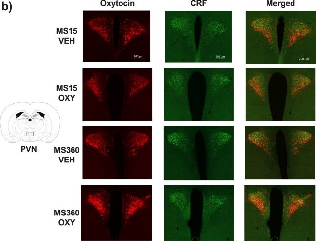 Fig.4.B showing Immunocytochemistry-immunofluorescence in a Rattus norvegicus (Rat) sample from the publication: Oxytocin as an adolescent treatment for methamphetamine addiction after early life stress in male and female rats.