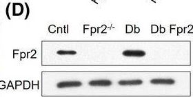 Fig.1.D showing Western Blotting in a Mus musculus (House mouse) sample from the publication: The G-protein-coupled chemoattractant receptor Fpr2 exacerbates neuroglial dysfunction and angiogenesis in diabetic retinopathy.