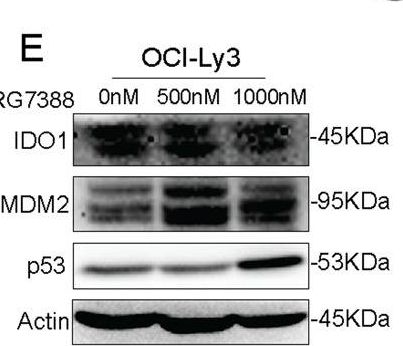 Fig.6.E showing Western Blotting in a Homo sapiens (Human) sample from the publication: IDO1 plays a tumor-promoting role via MDM2-mediated suppression of the p53 pathway in diffuse large B-cell lymphoma.