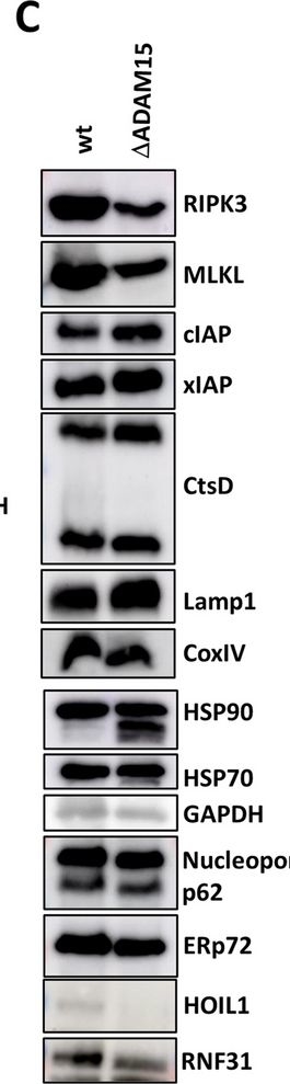 Fig.4.C showing Western Blotting in a Homo sapiens (Human) sample from the publication: Loss of ADAM15 prevents necroptosis induction by partial RIPK1 degradation due to enhanced TNF-R1 surface expression and basal caspase-8 activation.