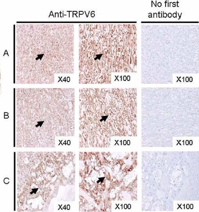 Fig.4.A showing Immunohistochemistry from the publication: Uterine and placental expression of TRPV6 gene is regulated via progesterone receptor- or estrogen receptor-mediated pathways during pregnancy in rodents.