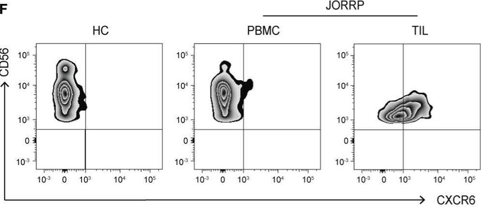 Fig.5.F showing Flow cytometry/Cell sorting in a Homo sapiens (Human) sample from the publication: Reduced NK Cell Cytotoxicity by Papillomatosis-Derived TGF-β Contributing to Low-Risk HPV Persistence in JORRP Patients.