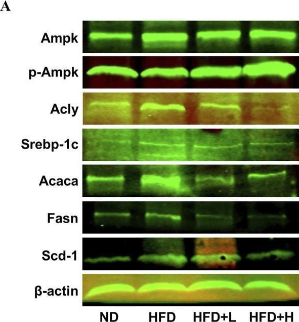 Fig.6.A showing Western Blotting in a Mus musculus (House mouse) sample from the publication: Unraveling the molecular mechanisms of Fufangduzhong formula in alleviating high-fat diet-induced non-alcoholic fatty liver disease in mice.