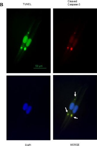Fig.6.B showing Immunocytochemistry-immunofluorescence in a Homo sapiens (Human) sample from the publication: Non-apoptotic role of caspase enzymes in satellite cells from human skeletal muscle.