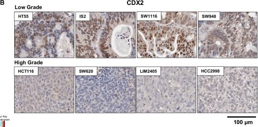 Fig.3.B showing Immunohistochemistry in a Mus musculus (House mouse) sample from the publication: Model systems and unique biological features of high and low-grade colorectal cancer (CRC) revealed by xenografting 84 human CRC cell lines.