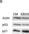 Fig.3.B showing Western Blotting in a Homo sapiens (Human) sample from the publication: Serum-nutrient starvation induces cell death mediated by Bax and Puma that is counteracted by p21 and unmasked by Bcl-x(L) inhibition.