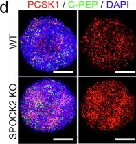 Fig.4.D showing Immunocytochemistry-immunofluorescence from the publication: SPOCK2 controls the proliferation and function of immature pancreatic β-cells through MMP2.