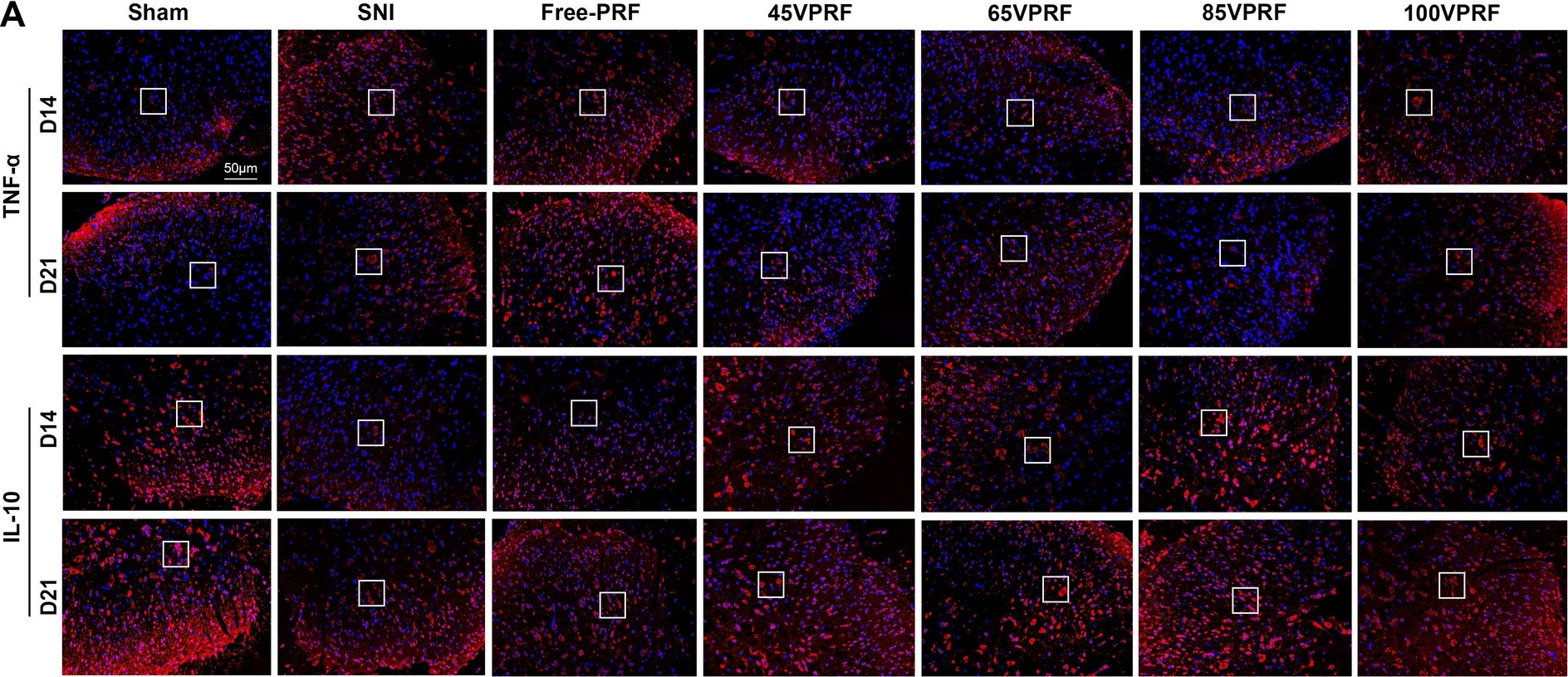 Fig.5.A showing Immunocytochemistry-immunofluorescence from the publication: High-voltage pulsed radiofrequency improves ultrastructure of DRG and enhances spinal microglial autophagy to ameliorate neuropathic pain induced by SNI.