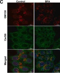 Fig.3.C showing Immunocytochemistry-immunofluorescence from the publication: Glycosylation of ceramide synthase 6 is required for its activity.