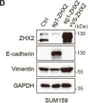 Fig.2.D showing Western Blotting from the publication: ZHX2 deficiency enriches hybrid MET cells through regulating E-cadherin expression.
