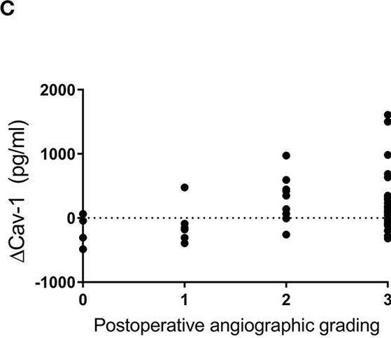 Fig.2.C showing Enzyme-linked immunosorbent assay from the publication: Caveolin-1 Promoted Collateral Vessel Formation in Patients With Moyamoya Disease.
