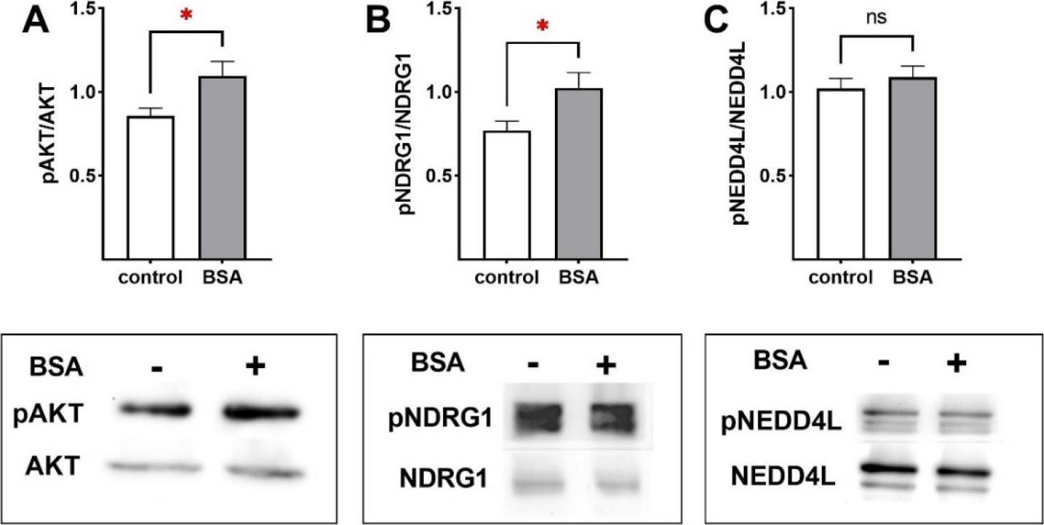 Fig.7.A showing Western Blotting from the publication: Albumin Stimulates Epithelial Na+ Transport and Barrier Integrity by Activating the PI3K/AKT/SGK1 Pathway.