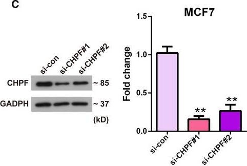 Fig.2.C showing Western Blotting in a Homo sapiens (Human) sample from the publication: Chondroitin polymerizing factor promotes breast carcinoma cell proliferation, invasion and migration and affects expression of epithelial-mesenchymal transition-related markers.