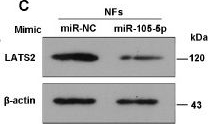 Fig.4.C showing Western Blotting from the publication: Breast cancer-derived exosomal miR-105-5p facilitates the transformation of NFs into CAFs through LATS2-NF-κB signaling.