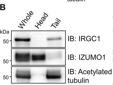 Fig.5.B showing Western Blotting from the publication: IRGC1, a testis-enriched immunity related GTPase, is important for fibrous sheath integrity and sperm motility in mice.