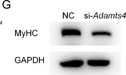 Fig.7.G showing Western Blotting in a Mus musculus (House mouse) sample from the publication: ADAMTS4 Reduction Contributes to Extracellular Matrix Deposition and Impaired Myogenesis in the Skeletal Muscle of Cigarette Smoke-Exposed Mice.