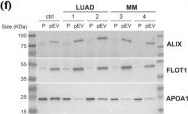 Fig.2.F showing Western Blotting in a Homo sapiens (Human) sample from the publication: Defining the Soluble and Extracellular Vesicle Protein Compartments of Plasma Using In-Depth Mass Spectrometry-Based Proteomics.