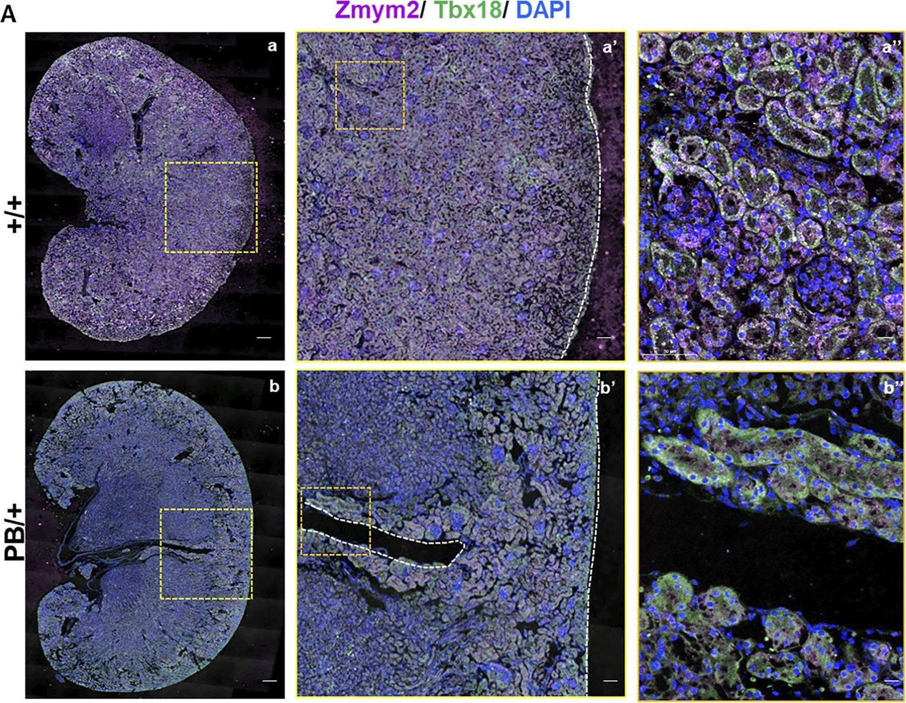 Fig.8.A showing Immunohistochemistry-immunofluorescence from the publication: Genitourinary defects, anxiety and aggressive-like behavior and glucose metabolism disorders in Zmym2 mutant mice with inserted piggyBac transposon.