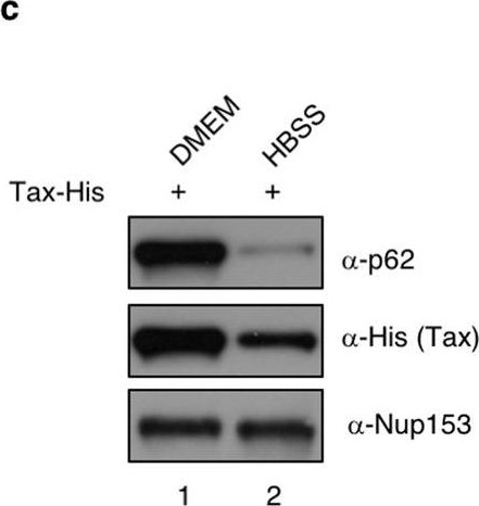SQSTM-1/p62 potentiates HTLV-1 Tax-mediated NF-κB activation through its ubiquitin binding function.