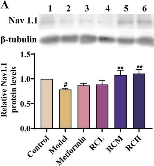 Fig.7.A showing Western Blotting in a Mus musculus (House mouse) sample from the publication: The potential role and mechanism of Rhizoma Coptidis in prevention of diabetic encephalopathy: targeting sodium ion and channels.