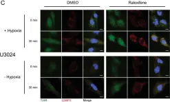 Fig.3.C showing Immunofluorescence in a Homo sapiens (Human) sample from the publication: Raloxifene prevents stress granule dissolution, impairs translational control and promotes cell death during hypoxia in glioblastoma cells.