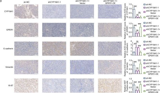 Fig.8.D showing Immunohistochemistry from the publication: Identification of the CYP19A1-GPER1 axis as a critical oncogenic driver in hepatocellular carcinoma via AKT activation.