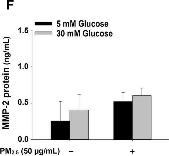 Fig.10.F showing Enzyme-linked immunosorbent assay from the publication: High glucose enhances the activation of NLRP3 inflammasome by ambient fine particulate matter in alveolar macrophages.