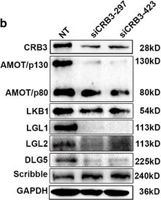 Fig.3.B showing Western Blotting in a Homo sapiens (Human) sample from the publication: CRB3 downregulation confers breast cancer stem cell traits through TAZ/β-catenin.
