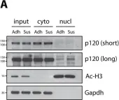 Fig.4.A showing Western Blotting in a Mus musculus (House mouse) sample from the publication: Nuclear p120-catenin regulates the anoikis resistance of mouse lobular breast cancer cells through Kaiso-dependent Wnt11 expression.