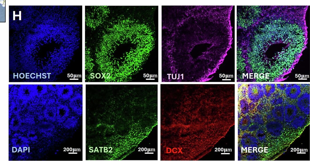 Fig.1.H showing Immunohistochemistry-immunofluorescence in a Homo sapiens (Human) sample from the publication: Patient-derived brain organoids reveal divergent neuronal activity across subpopulations of autism spectrum disorder.