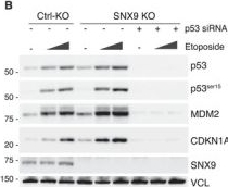 Fig.7.B showing Western Blotting in a Homo sapiens (Human) sample from the publication: Endocytic Control of Cell-Autonomous and Non-Cell-Autonomous Functions of p53.