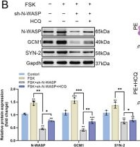 Fig.9.B showing Western Blotting in a Homo sapiens (Human) sample from the publication: Reduced Wiskott-Aldrich syndrome protein expression in preeclampsia placenta impairs trophoblast syncytialization by modulating syncytin-2 via FAK/β-catenin pathway.