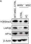 Fig.3.A showing Western Blotting in a Mus musculus (House mouse) sample from the publication: Vitamin C alleviates aging defects in a stem cell model for Werner syndrome.
