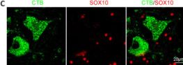 Fig.4.F showing Immunohistochemistry-immunofluorescence from the publication: Tracing motor neurons and primary sensory afferents of the monkey spinal cord with cholera toxin subunit B.