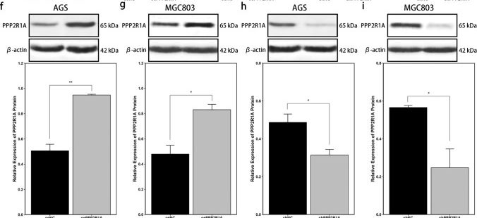 Fig.3.F showing Western Blotting in a Homo sapiens (Human) sample from the publication: Silencing PPP2R1A inhibits the progression of gastric cancer cells.
