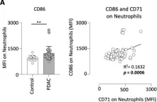 Fig.2.A showing Flow cytometry/Cell sorting in a Homo sapiens (Human) sample from the publication: CD71 expressing circulating neutrophils serve as a novel prognostic biomarker for metastatic spread and reduced outcome in pancreatic ductal adenocarcinoma patients.